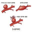 하에 Daum백과