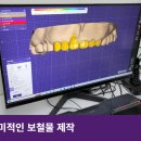 청도치과기공소 네이버블로그