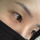 결 | 대구 LED펌포인트 연장 받고 유지력 만족한 늘봄결 후기