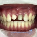 덴탈아트치과기공소 이미지