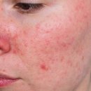 김성원한의원 이미지