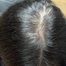 메디엑스퍼트 이미지