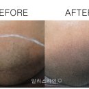 일러스라인 이미지