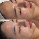 리베 | 안양 리베룩 톤업 광채 후기 - 커스텀미 피부관리 추천