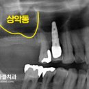 서울미라클치과의원 이미지
