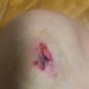 이승훈외과의원 | 김해 장유 무계 이승훈 외과 이용후기 #내돈내치