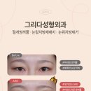 자연스러움과 조화를 고려한 쌍꺼풀 + 눈밑지방재배치 수술 후기