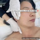 네일해 | 충남 천안 청당동 두피에서 네일까지 플라즈마 줄기세포 어머니 해드린 후기