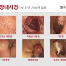 변내과의원 네이버블로그