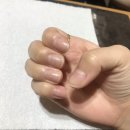 지니스네일