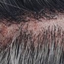 헤드샷스칼프본점 이미지