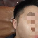 김재준피부과의원 네이버블로그
