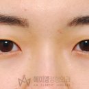 에이엠성형외과의원 이미지