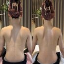 위례바른약국 | 강력추천 위례피부관리 디에유에스테틱위례점