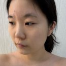 북아현동 주민센터 | 아현피부관리 라르본뷰티 V라인리프팅 라르본 이그제큐티브 케어 후기