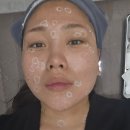 미금메이퓨어의원 네이버블로그