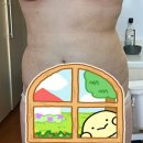 아쥬르의원 | 결혼준비와 웨딩드레스가 입고 싶어 한 복부지방흡입 후기 3주차 후기