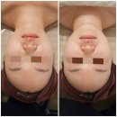 검단자이1단지아파트 앞 사거리 | 끌올림뷰티 검단점 웨딩케어(하이퍼소닉+윤곽 수기관리) 후기