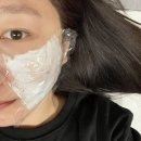 수일침한의원 | 여드름흉터치료 한의원 새살침 6회차 후기