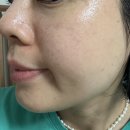 오늘의피부 - 전주시 덕진구 | 목포 스킨플래닝 711뷰티 세라링 피부관리 후기