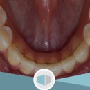 신우플러스원 이미지