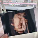 철수세탁방 | [임신 30주 ~ 32주] 2025년 안녕! / 임신 후기 증상 기록 / 임신 후기 쇼핑 고민