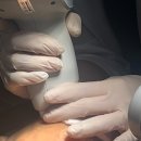 미소로약국 | 부모님 효도선물 리팟레이저 효과 후기, 강남 논현피부과 흑자제거 추천