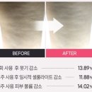 쥬비피부관리