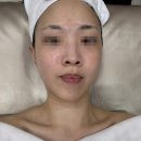 초지역 피부샵 &#39;연뷰티앤바디&#39; 진정 재생 케어 만족 후기