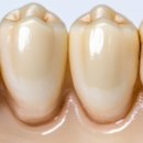 마린플란트치과의원 이미지