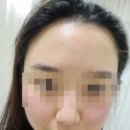 용인 역북동웨딩관리 처인구에스테틱 추천 더이쁜피부 솔직 후기