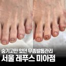 강북우리들병원 화장실 | 숨기고만 있던 무좀발톱 관리, 강북 창동 레푸스 미아점에서 해결