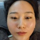 에스테틱베이비페이스 이미지