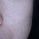 박앤박피부과의원 이미지