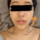 세븐일레븐 광주수기모아점 | 광주쌍촌동 모공관리 전문샵<수얀스킨케어> 림프순환수분케어후기🧸🧸