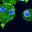 (주)다우진유전자연구소 | [흑사병] 단 하나의 유전자 진화가 어떻게 흑사병의 적응과 장기화를 가능하게 했는가