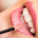 브리에의원 이미지