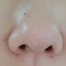 슈링