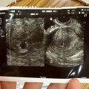 원포 배란테스트기로 임신성공 후기! 데이비드 스마일 슈퍼패스트 임테기와 파이널체크 임테기 후기