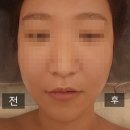 삼척 셀포랩채움 : 누워서 하는 다이어트 체형관리숍 후기