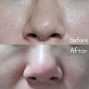 씨유 서영더엘점 | 검단 아라동 모공 관리 효과 확실한 피부관리샵 비비드엘 인천점 Vivid.L 추천