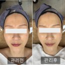 드림메디칼(주) | 고등동 피부관리 올가드림뷰티 판교고등점 에서 결혼식 1주일전 관리받기!