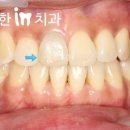 따뜻한인치과의원 이미지