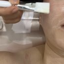 오렌지교통 | [서울/강서] 얼굴 소멸이 필요하다면? 오렌지브로우 윤곽관리와 이어테라피 리얼후기