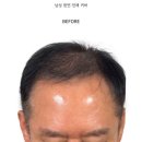 대구SMP