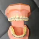 서울 훈 치과의원 | 종암동치과/서울훈치과의원