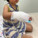 바른연합의원 | 월배 수액맞을 수 있는 추석 진료 병원 아기 수액실 어린이 영양링거 바른연합소아청소년과