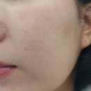 케어팜 | 눈 시림 없이 산뜻한 톤업! 유스케어팜 [레아필 히알루론산 톤업 선크림]추천 백탁없는 선크림