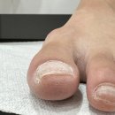 경기광주내성발톱 경안동네일샵 닥터아이티엔 오감네일 1회차 받아본 후기