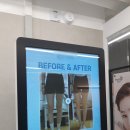 (주)팻라인 | 이오팻주사 허벅지지방분해주사 8회차 허벅지안쪽살과 무릎라인 다듬은 후기